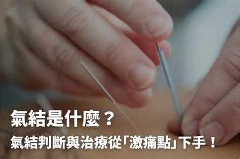 腰氣結|氣結是什麼？氣結判斷與治療從「激痛點」下手！